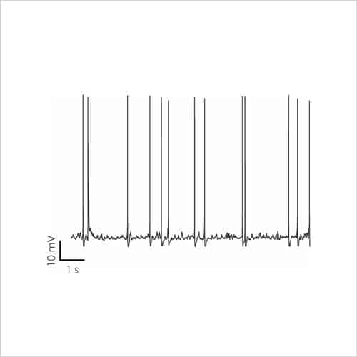 Neuroscience 13 Fig5a Rat cortical neurons 1