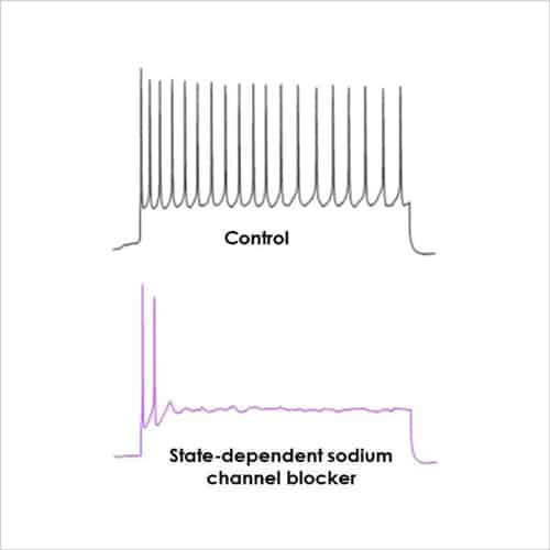 Figure 1 Current clamp recording