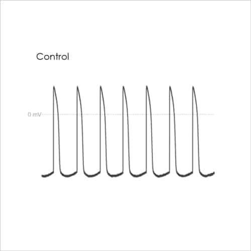 Cardiac Translational Manual Patch Assays 9 Figure 5a Landscape EAD