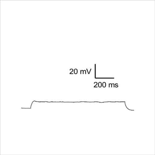 Neuroscience 16 Figure 7a hDRG firing