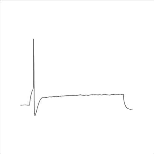 Neuroscience 17 Figure 7b hDRG firing