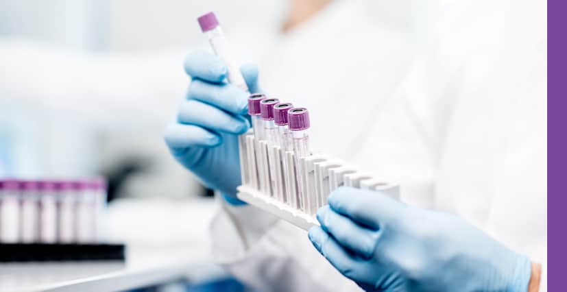 Identification of novel ion channel binders: TRPA1 antagonist case study 4 Metrion Biosciences Our Approach 2