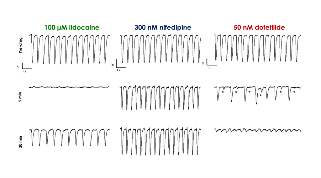 Development of an Impedance Based Screening Assay for Cardiac Safety and Cardiotoxicity Detection in Stem Cell-derived Cardiomyocytes 5 Figure 3 Acute cardiac effects 1