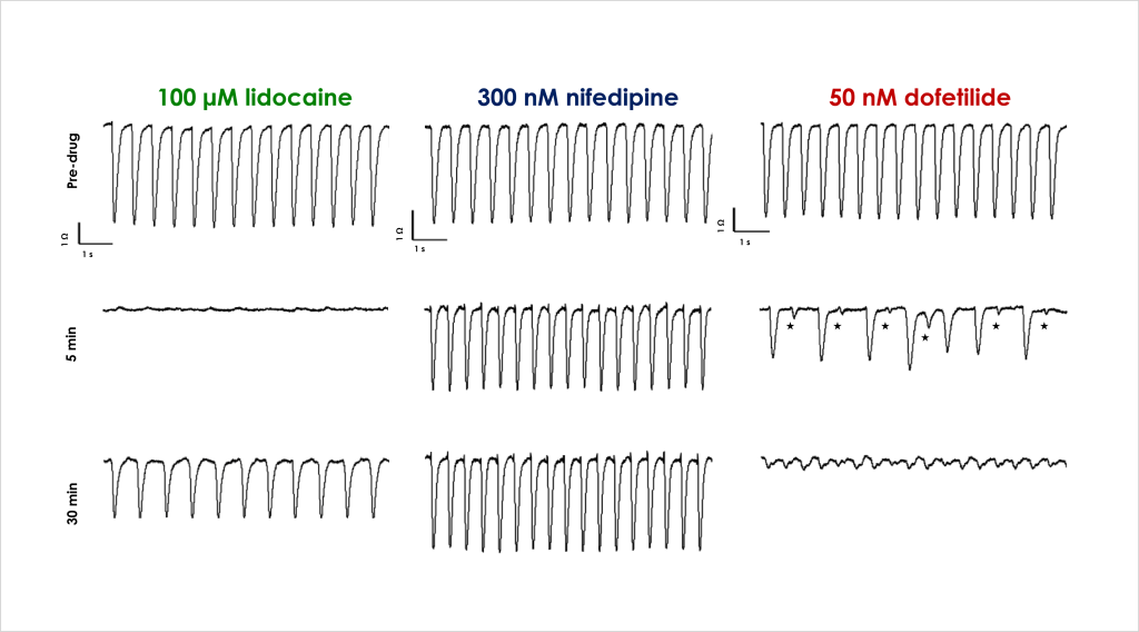 Figure 3 Acute cardiac effects 1